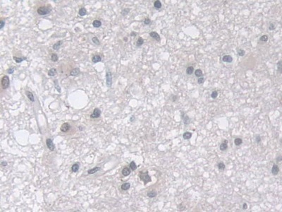 Polyclonal Antibody to Membrane Protein, Palmitoylated 5 (MPP5)