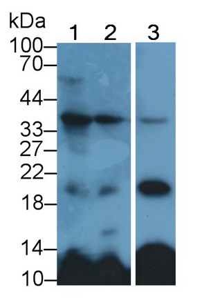 Polyclonal Antibody to Fibroblast Growth Factor 23 (FGF23)