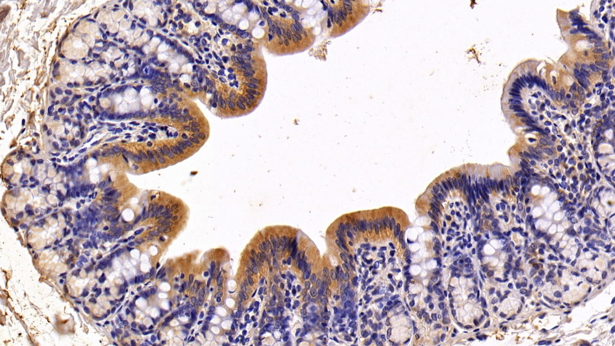 Polyclonal Antibody to Trefoil Factor 2 (TFF2)