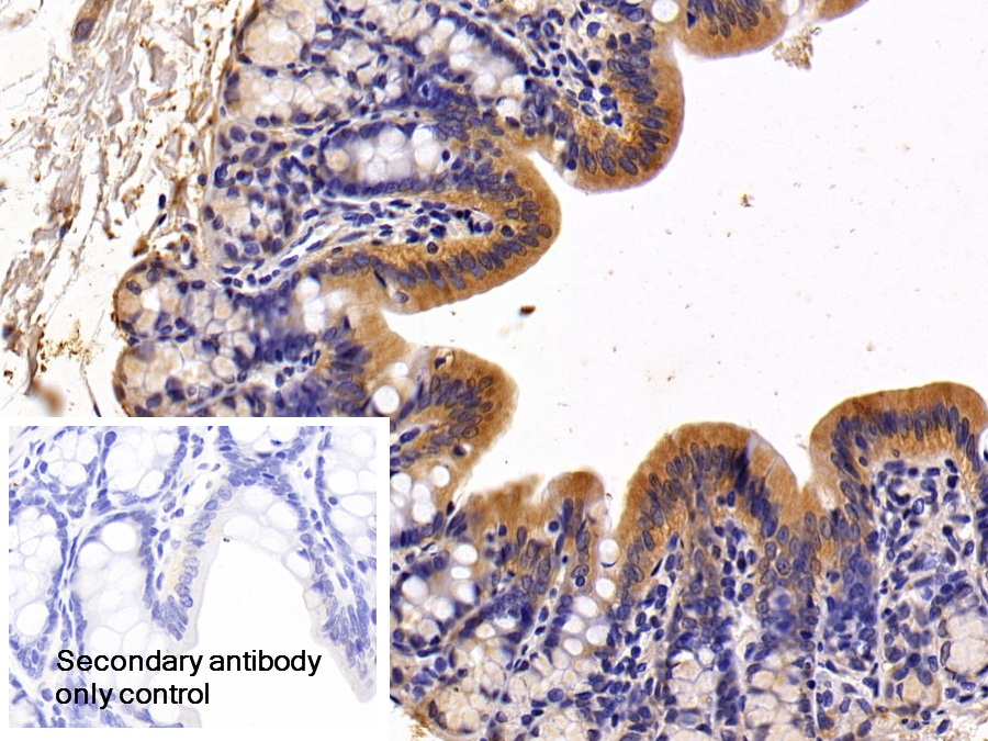 Polyclonal Antibody to Trefoil Factor 2 (TFF2)