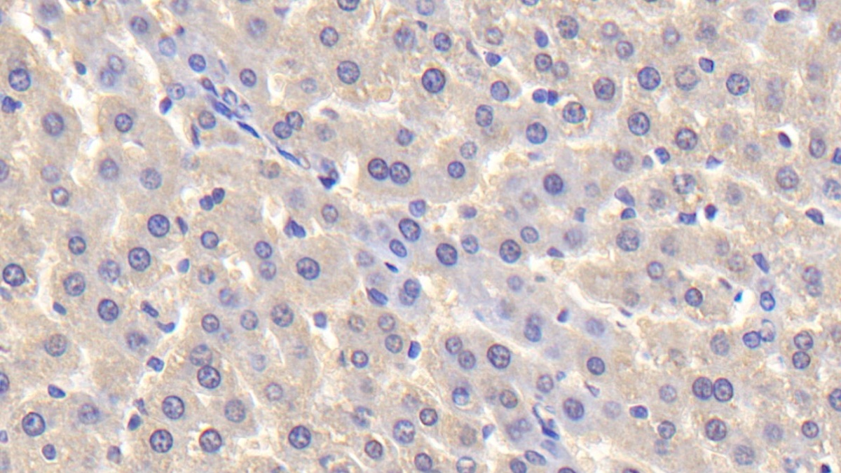 Polyclonal Antibody to Trefoil Factor 2 (TFF2)