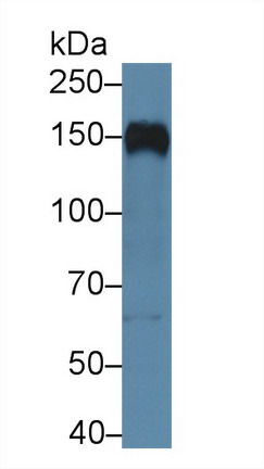 Polyclonal Antibody to Complement Receptor 2 (CD21)