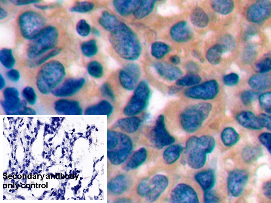 Polyclonal Antibody to Programmed Cell Death Protein 1 (PD1)