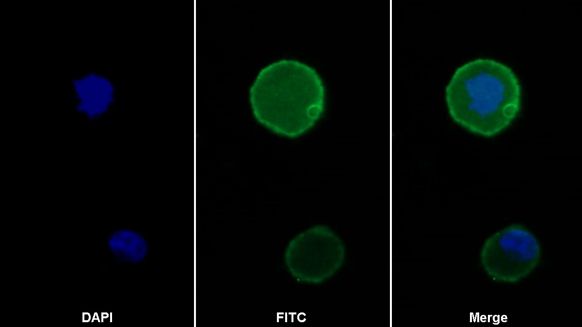 Polyclonal Antibody to Programmed Cell Death Protein 1 (PD1)