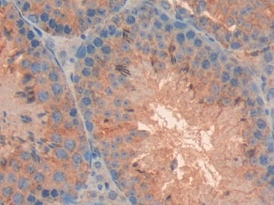 Polyclonal Antibody to Cluster Of Differentiation 38 (CD38)