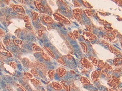 Polyclonal Antibody to Cluster Of Differentiation 38 (CD38)