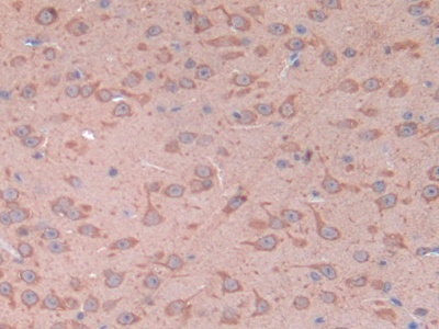 Polyclonal Antibody to Cluster Of Differentiation 38 (CD38)