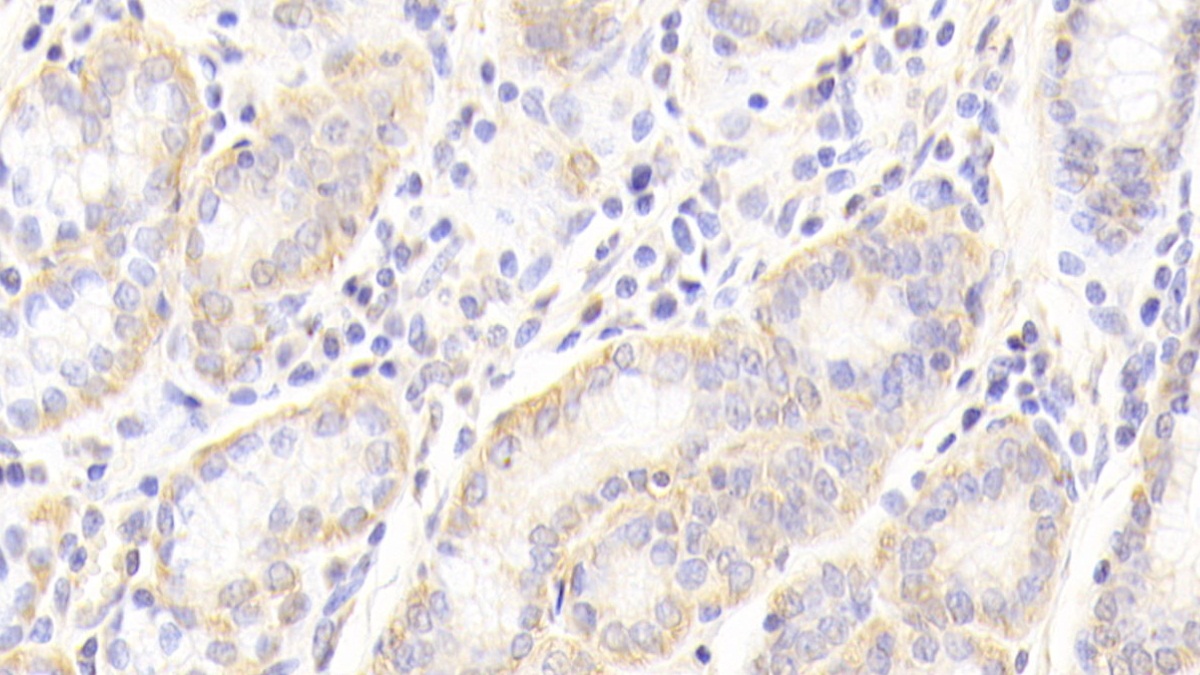 Polyclonal Antibody to Toll Like Receptor 4 (TLR4)