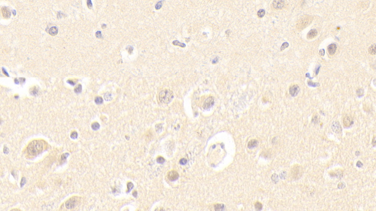 Polyclonal Antibody to Toll Like Receptor 4 (TLR4)