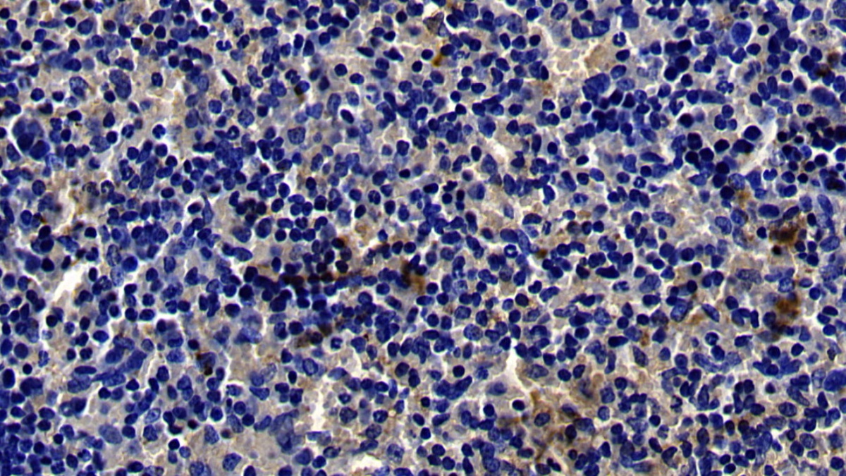 Polyclonal Antibody to Toll Like Receptor 4 (TLR4)