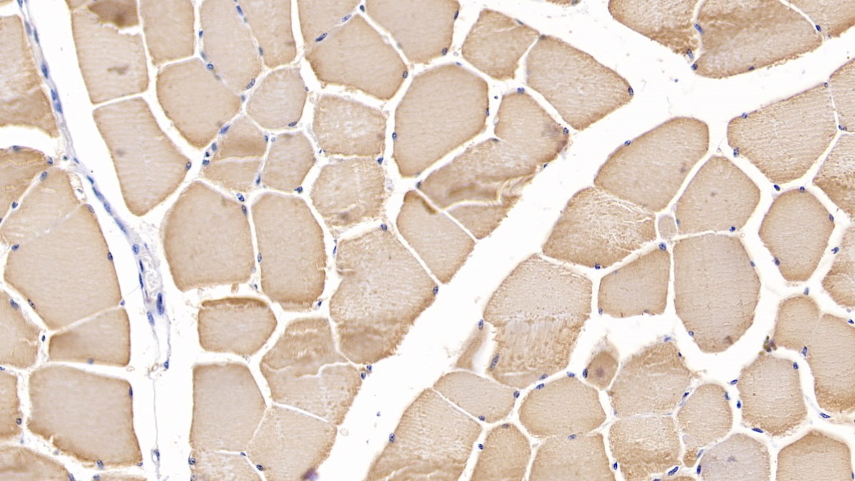 Polyclonal Antibody to Myosin Heavy Chain 2 (MYH2)