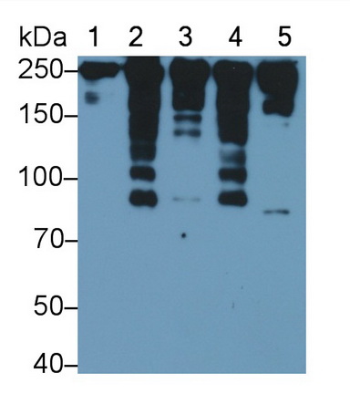 Polyclonal Antibody to Myosin Heavy Chain 2 (MYH2)