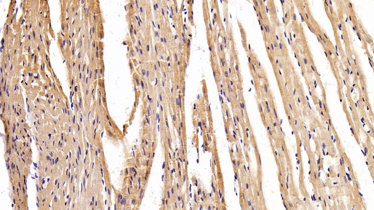 Polyclonal Antibody to Myosin Heavy Chain 2 (MYH2)