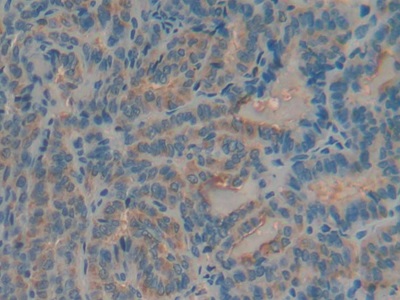 Polyclonal Antibody to Mucin 5 Subtype AC (MUC5AC)