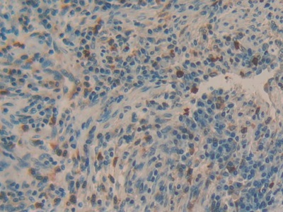 Polyclonal Antibody to Mucin 5 Subtype AC (MUC5AC)