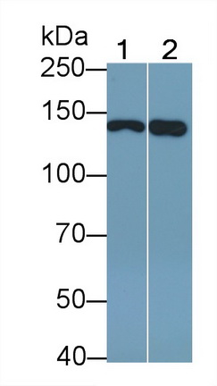 Polyclonal Antibody to Epidermal Growth Factor Receptor (EGFR)