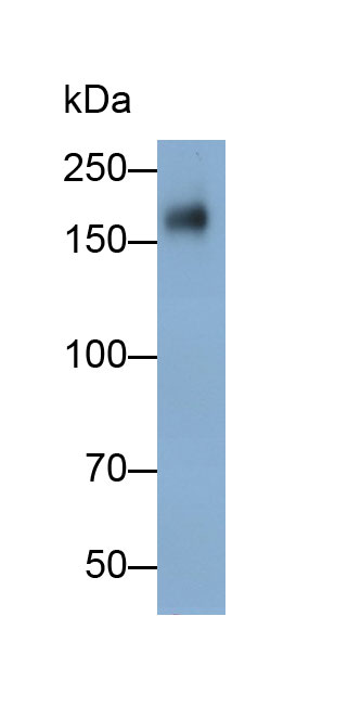 Polyclonal Antibody to Epidermal Growth Factor Receptor (EGFR)