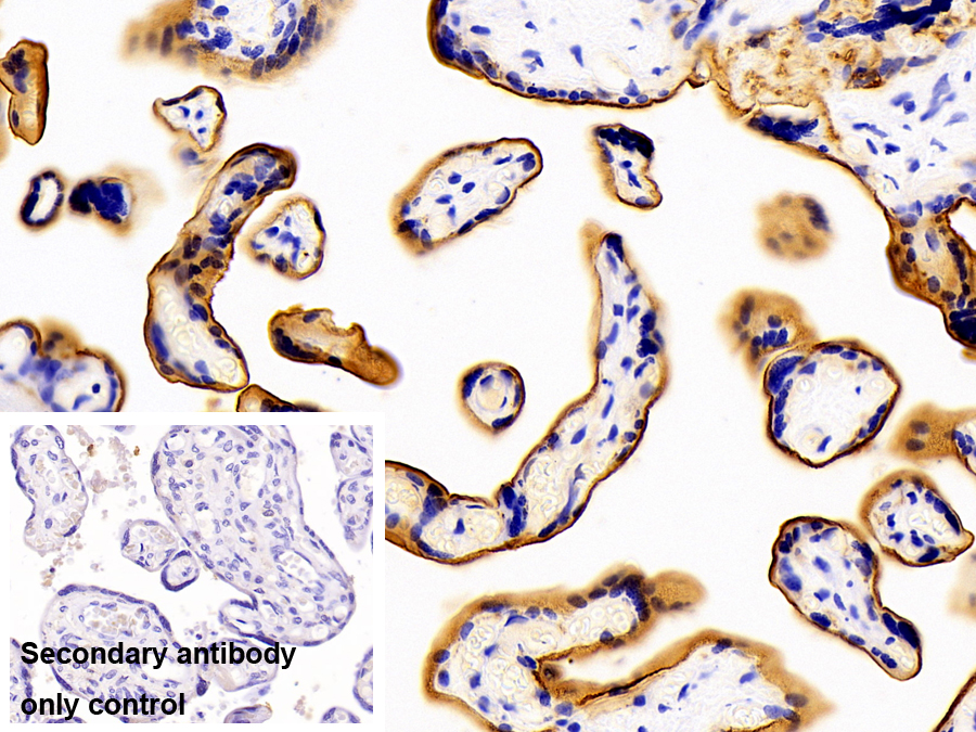 Polyclonal Antibody to Epidermal Growth Factor Receptor (EGFR)