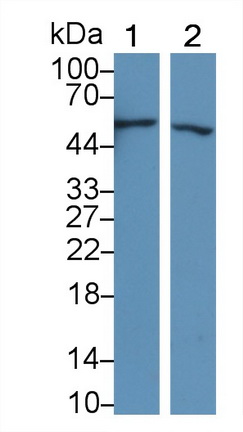 Polyclonal Antibody to C4 Binding Protein Beta (C4BPb)