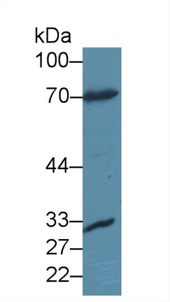 Polyclonal Antibody to Forkhead Box Protein O1 (FOXO1)