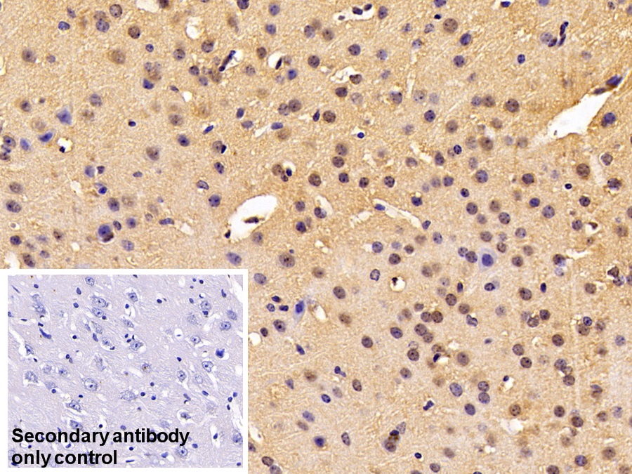 Polyclonal Antibody to Forkhead Box Protein O1 (FOXO1)