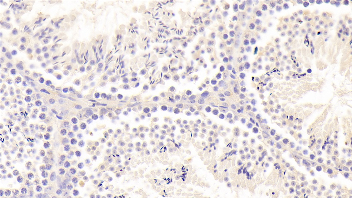 Polyclonal Antibody to Forkhead Box Protein O1 (FOXO1)