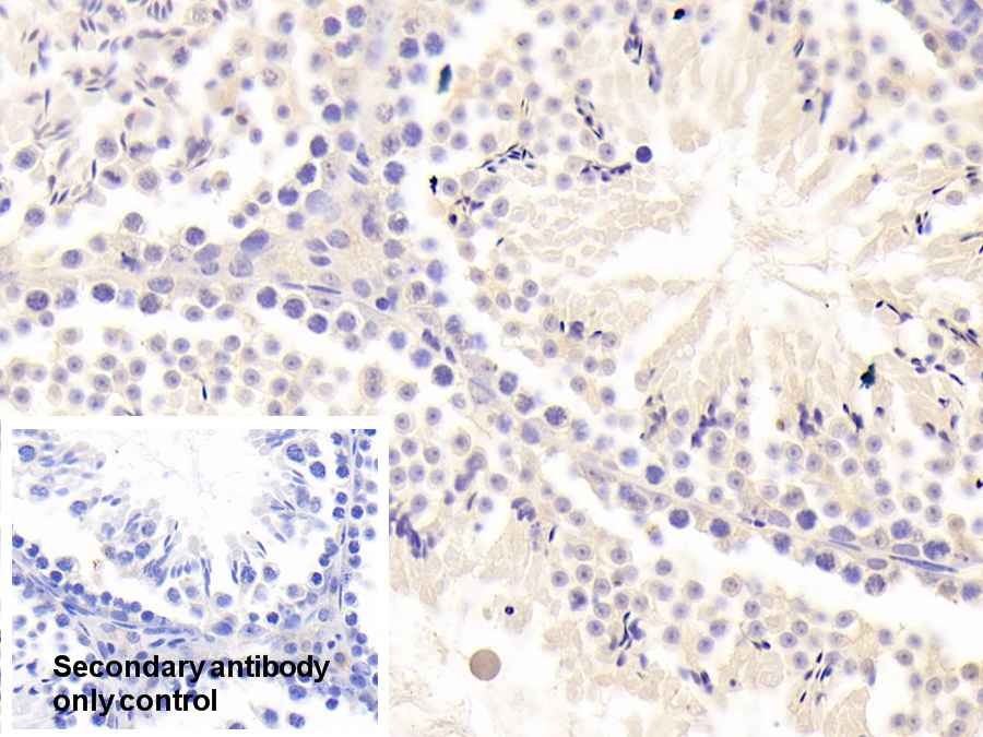 Polyclonal Antibody to Forkhead Box Protein O1 (FOXO1)