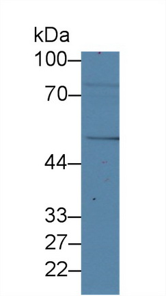 Polyclonal Antibody to Forkhead Box Protein P1 (FOXP1)