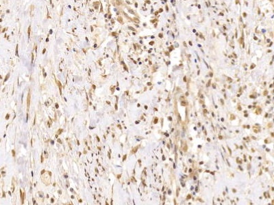 Polyclonal Antibody to Forkhead Box Protein P1 (FOXP1)