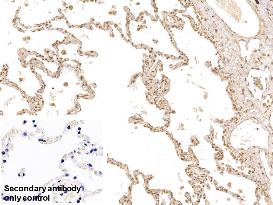 Polyclonal Antibody to Forkhead Box Protein P1 (FOXP1)