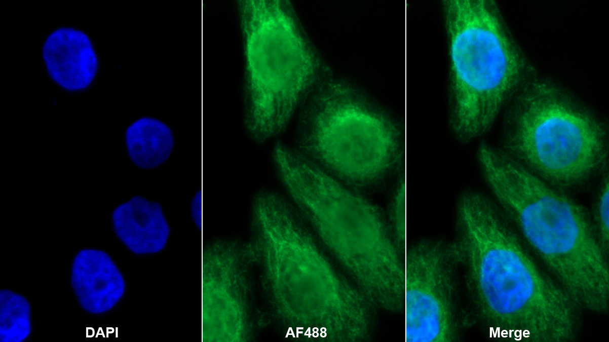 Polyclonal Antibody to Forkhead Box Protein P1 (FOXP1)