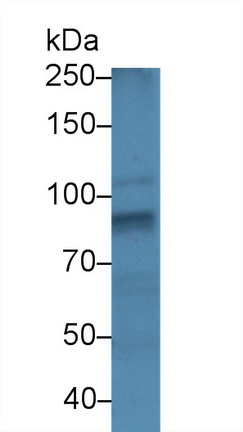 Polyclonal Antibody to Forkhead Box Protein P1 (FOXP1)