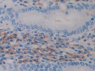 Polyclonal Antibody to A Disintegrin And Metalloprotease 10 (ADAM10)