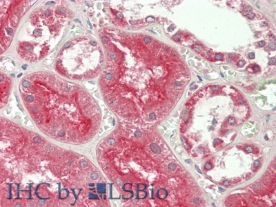 Polyclonal Antibody to A Disintegrin And Metalloprotease 10 (ADAM10)