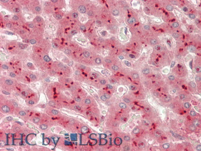 Polyclonal Antibody to A Disintegrin And Metalloprotease 10 (ADAM10)