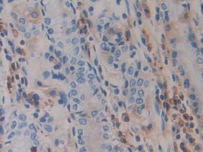 Polyclonal Antibody to A Disintegrin And Metalloprotease 10 (ADAM10)