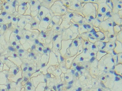 Polyclonal Antibody to Podocalyxin (PODXL)