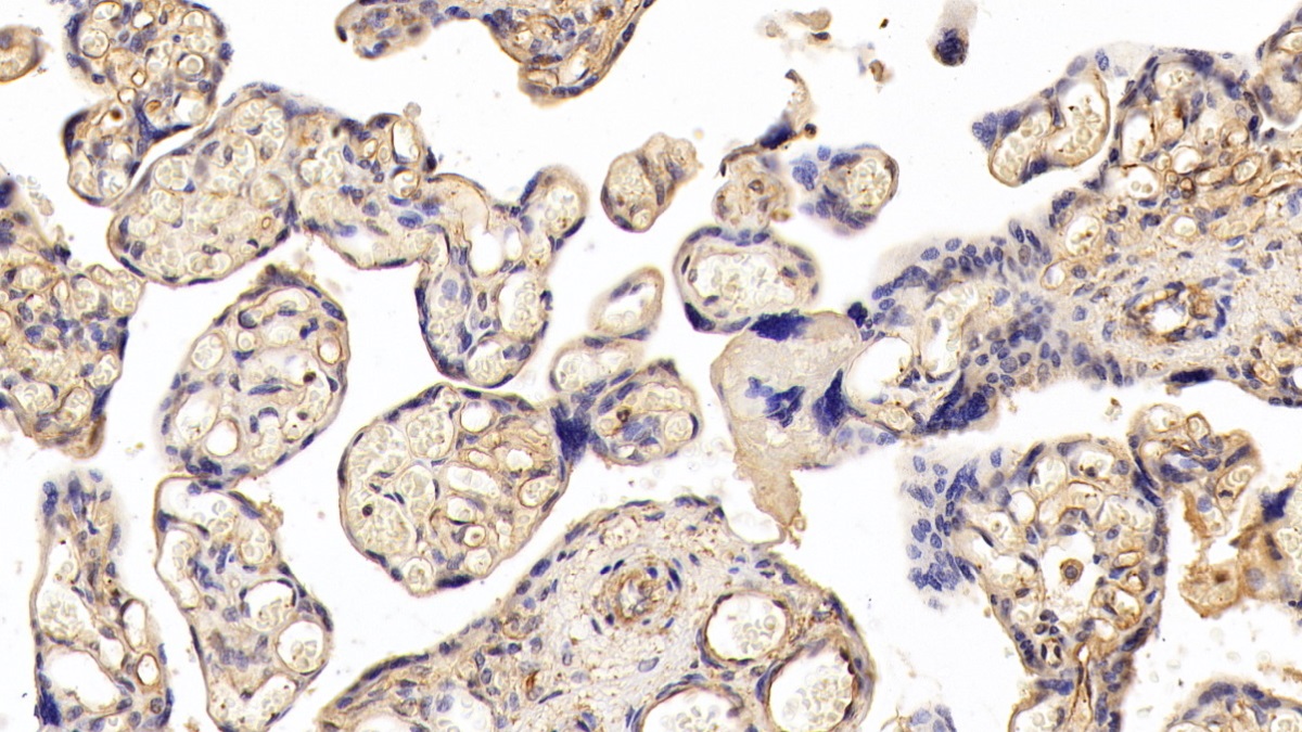 Polyclonal Antibody to Podocalyxin (PODXL)