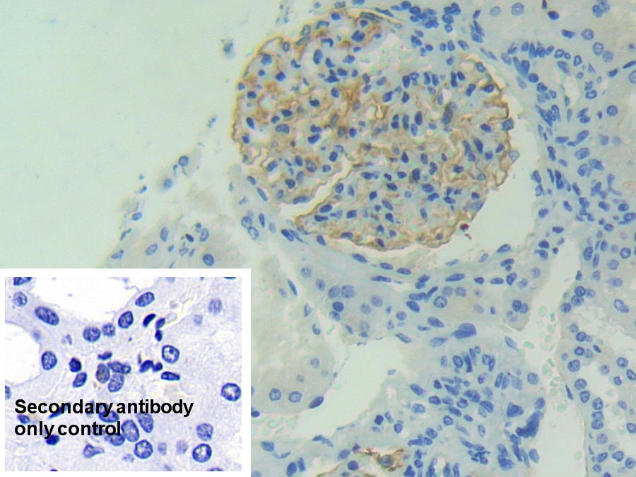 Polyclonal Antibody to Podocalyxin (PODXL)