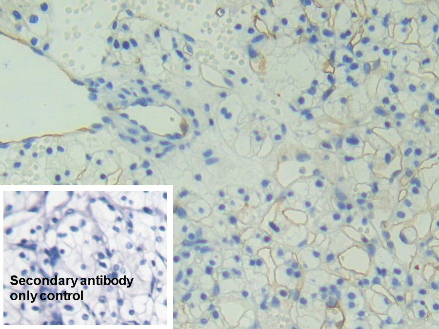 Polyclonal Antibody to Podocalyxin (PODXL)