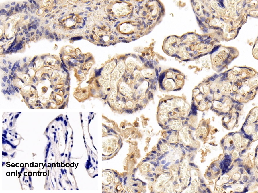 Polyclonal Antibody to Podocalyxin (PODXL)