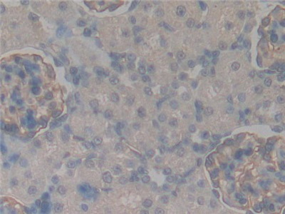 Polyclonal Antibody to Podocalyxin (PODXL)