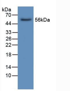 Polyclonal Antibody to Lipase, Hepatic (LIPC)