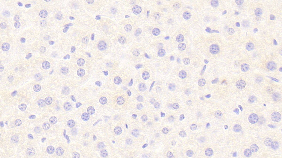 Polyclonal Antibody to Lipase, Hepatic (LIPC)