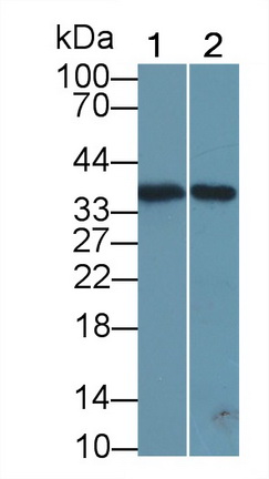 Polyclonal Antibody to Chemokine C-X-C-Motif Ligand 16 (CXCL16)