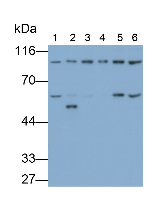 Polyclonal Antibody to Glucocorticoid Receptor Alpha (GRa)