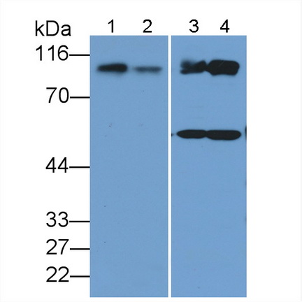 Polyclonal Antibody to Hexokinase 1 (HK1)