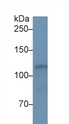 Polyclonal Antibody to Hexokinase 1 (HK1)