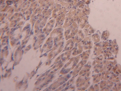 Polyclonal Antibody to Hexokinase 1 (HK1)