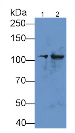 Polyclonal Antibody to Hexokinase 1 (HK1)